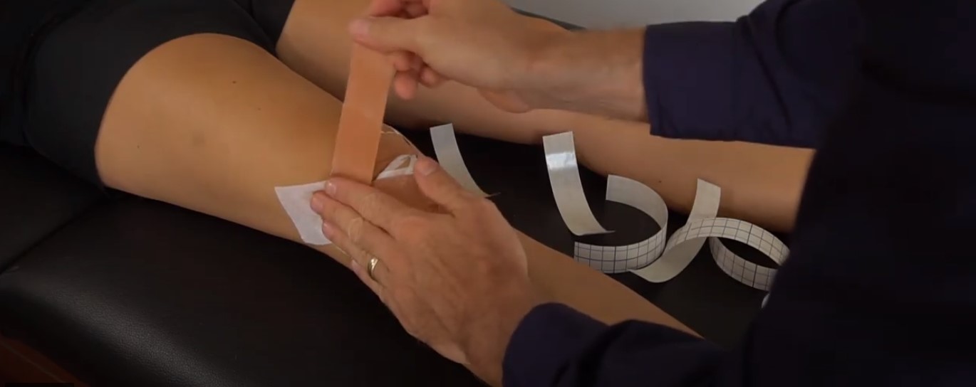 How to Tape a Knee in 4 Techniques