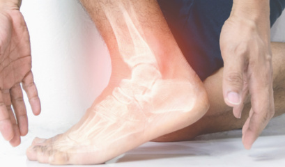 Ankle Sprain